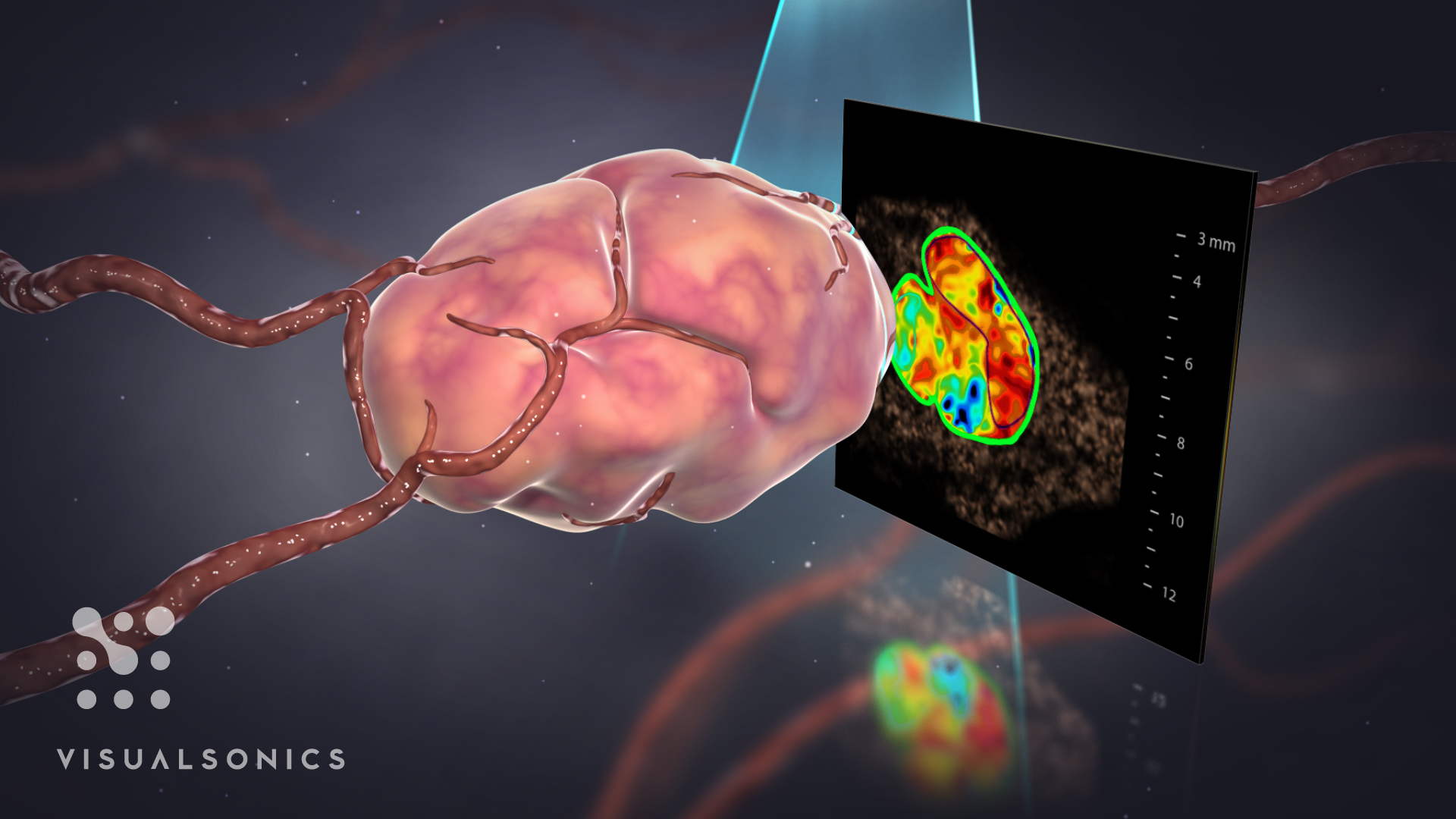 Visualsonics 3D Ultrasound Technology Artery Studios HealthCare Visuals
