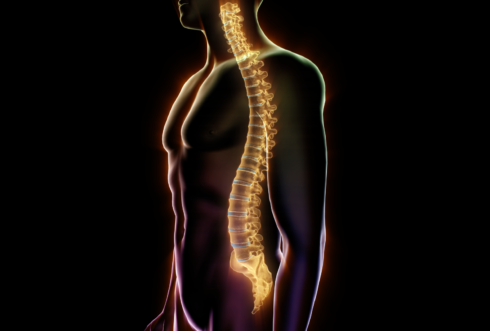 Spinal Cord Injury | Artery Studios - HealthCare Visuals